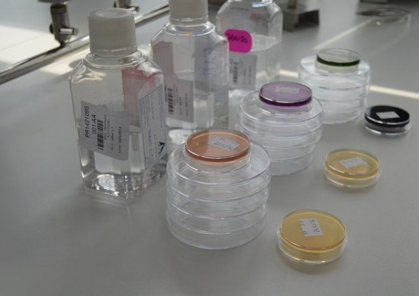 Petriho misky v našom mikrobiologickom laboratóriu. 